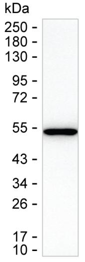 TXNDC5